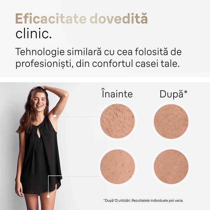Epilatore IPL Braun Silk-expert Pro 5 PL5152
